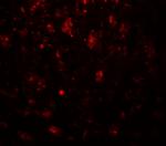 CADM3 Antibody in Immunohistochemistry (Paraffin) (IHC (P))
