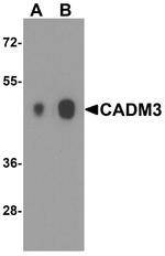 CADM3 Antibody in Western Blot (WB)