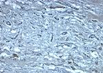 Nephrin Polyclonal Antibody