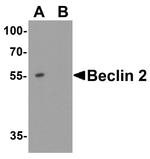 WWC1 Antibody in Western Blot (WB)