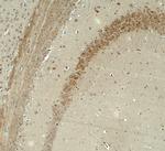 IQSEC2 Polyclonal Antibody