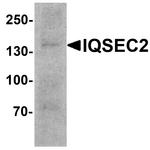 IQSEC2 Antibody in Western Blot (WB)