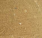 STEP Polyclonal Antibody