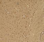 KCNK1 Polyclonal Antibody