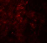 SESN2 Antibody in Immunohistochemistry (Paraffin) (IHC (P))