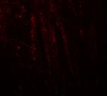 RHOT1 Antibody in Immunohistochemistry (Paraffin) (IHC (P))