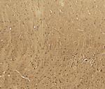 CaV3.2 Polyclonal Antibody