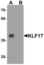 KLF17 Antibody in Western Blot (WB)