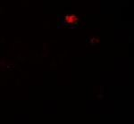 PPM1D Antibody in Immunohistochemistry (Paraffin) (IHC (P))