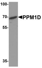 PPM1D Antibody in Western Blot (WB)