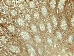 EPLIN Antibody in Immunohistochemistry (Paraffin) (IHC (P))