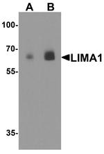 EPLIN Antibody in Western Blot (WB)