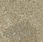 DTX4 Polyclonal Antibody