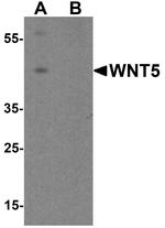 WNT5B Antibody in Western Blot (WB)