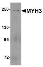 MYH3 Antibody in Western Blot (WB)