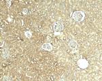GLIS2 Polyclonal Antibody