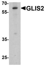 GLIS2 Antibody in Western Blot (WB)