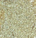ADRM1 Polyclonal Antibody