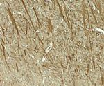 TENM3 Polyclonal Antibody