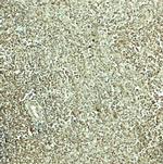 SNRPN Polyclonal Antibody