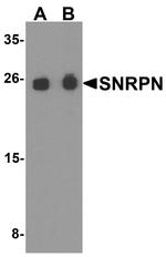 SNRPN Antibody in Western Blot (WB)