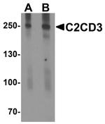 C2CD3 Antibody in Western Blot (WB)