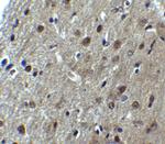 ARID1A Polyclonal Antibody