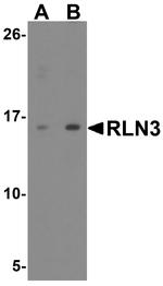 Relaxin 3 Antibody in Western Blot (WB)