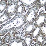 ADAM29 Polyclonal Antibody