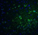 PACS1 Polyclonal Antibody