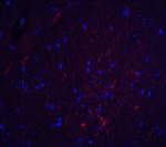 S1PR2 Polyclonal Antibody