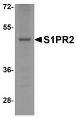 S1PR2 Antibody in Western Blot (WB)