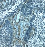 PALMD Polyclonal Antibody