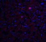 TRO Antibody in Immunohistochemistry (Paraffin) (IHC (P))