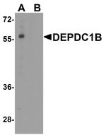 DEPDC1B Antibody in Western Blot (WB)