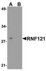 RNF121 Antibody in Western Blot (WB)