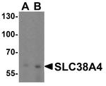 SLC38A4 Antibody in Western Blot (WB)