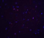 TNFAIP1 Polyclonal Antibody