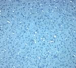 DIS3L2 Polyclonal Antibody