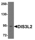 DIS3L2 Antibody in Western Blot (WB)