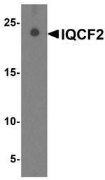 IQCF2 Antibody in Western Blot (WB)