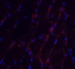 CHADL Polyclonal Antibody