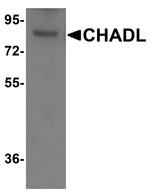 CHADL Antibody in Western Blot (WB)