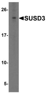 SUSD3 Antibody in Western Blot (WB)