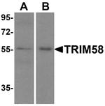 TRIM58 Polyclonal Antibody