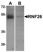 RNF26 Antibody in Western Blot (WB)