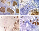 NCOA6 Antibody in Immunohistochemistry (Paraffin) (IHC (P))