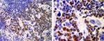 NCOA6 Antibody in Immunohistochemistry (Paraffin) (IHC (P))