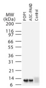 NCOA6 Antibody in Western Blot (WB)