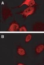 BAG2 Antibody in Immunocytochemistry (ICC/IF)